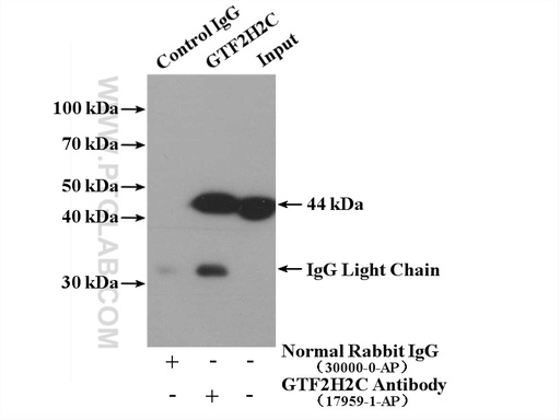 [17959-1-AP-150UL] GTF2H2C Polyclonal antibody
