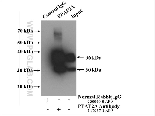 [17967-1-AP-20UL] PPAP2A Polyclonal antibody