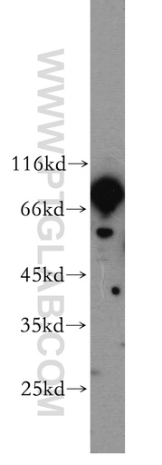 [17970-1-AP-150UL] RGS9 Polyclonal antibody