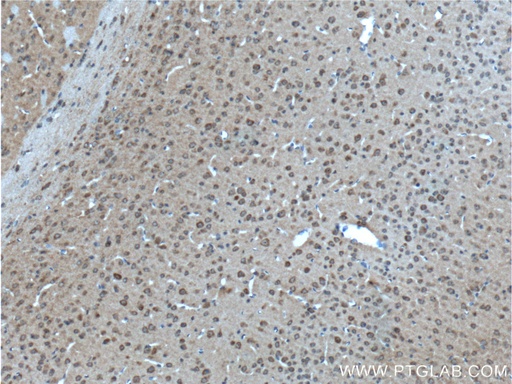 [17972-1-AP-150UL] GPR75 Polyclonal antibody