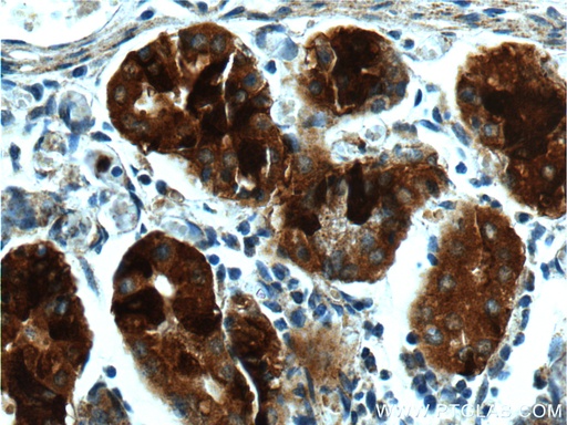 [17973-1-AP-150UL] GPR21 Polyclonal antibody