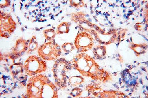 [17974-1-AP-150UL] BPHL Polyclonal antibody