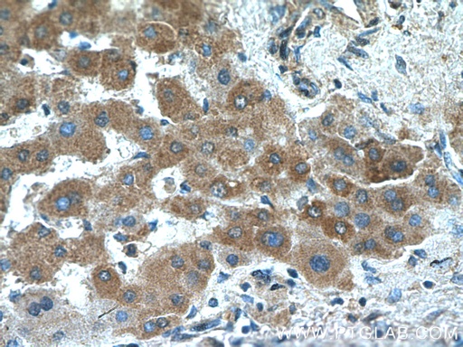 [17975-1-AP-20UL] Acetylcholinesterase Polyclonal antibody
