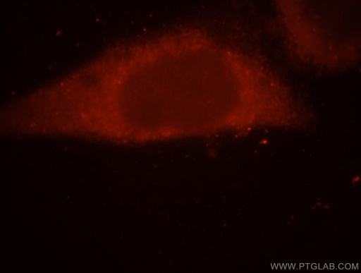 [17976-1-AP-20UL] SRP54 Polyclonal antibody