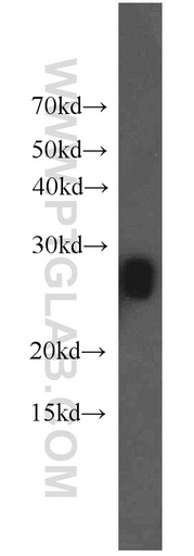 [17977-1-AP-20UL] MIP Polyclonal antibody