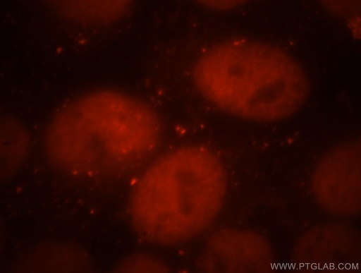 [17980-1-AP-150UL] Cdc7 Kinase Polyclonal antibody