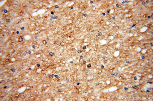 [17982-1-AP-150UL] UGT8 Polyclonal antibody