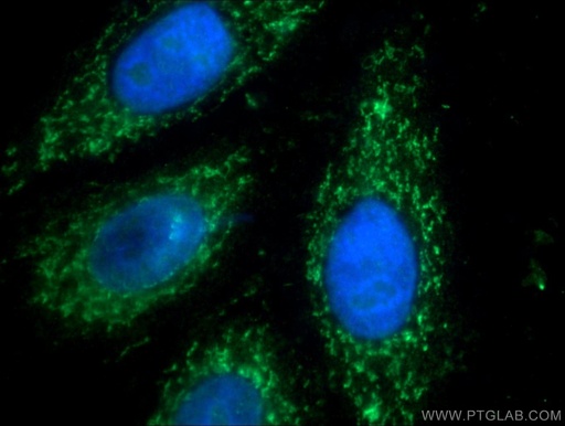 [17984-1-AP-150UL] AIF Polyclonal antibody