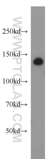 [17987-1-AP-150UL] ADNP Polyclonal antibody
