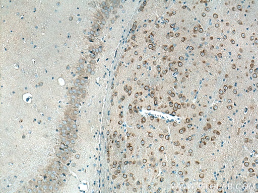 [17988-1-AP-150UL] REEP1 Polyclonal antibody