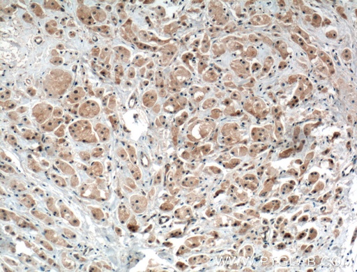 [17991-1-AP-20UL] PRKAR1B Polyclonal antibody