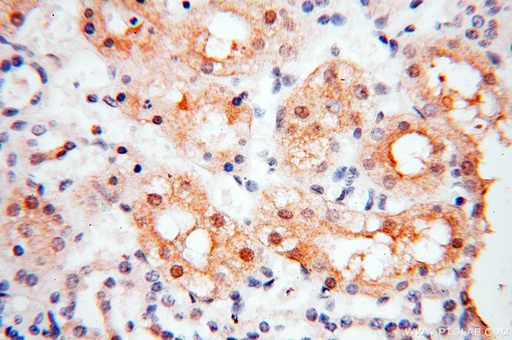 [18001-1-AP-150UL] PPCS Polyclonal antibody