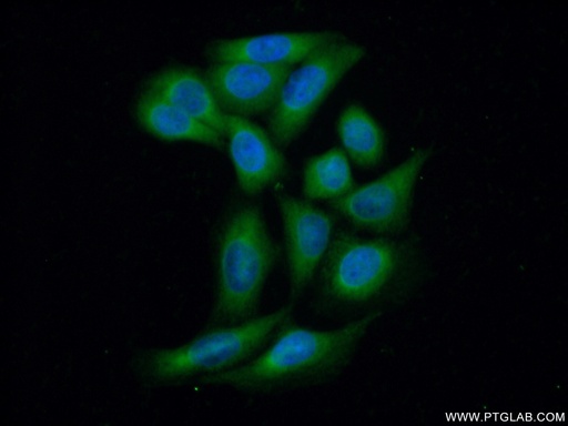 [18002-1-AP-20UL] PP11 Polyclonal antibody