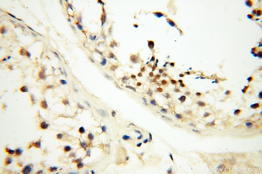 [18003-1-AP-150UL] DNA Polymerase Beta Polyclonal antibody
