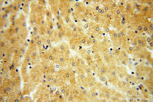 [18004-1-AP-20UL] ST8SIA3 Polyclonal antibody