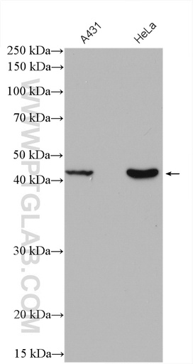 [18005-1-AP-20UL] RRM2B,p53R2 Polyclonal antibody