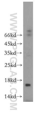 [18007-1-AP-150UL] CREBL2 Polyclonal antibody