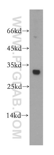 [18009-1-AP-150UL] Nucleoside phosphorylase Polyclonal antibody
