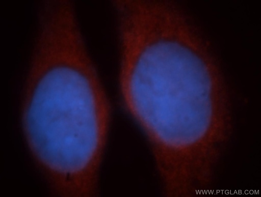 [18010-1-AP-20UL] EIF2B1 Polyclonal antibody