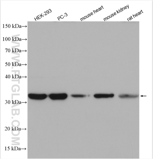 [18016-1-AP-20UL] ATPAF1 Polyclonal antibody