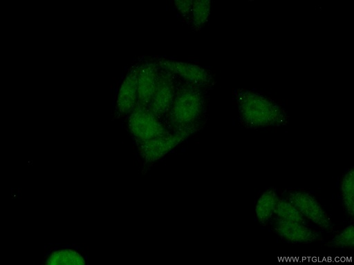[18018-1-AP-20UL] PLAG1 Polyclonal antibody