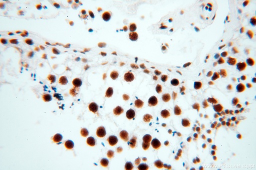 [18025-1-AP-150UL] SART3 Polyclonal antibody
