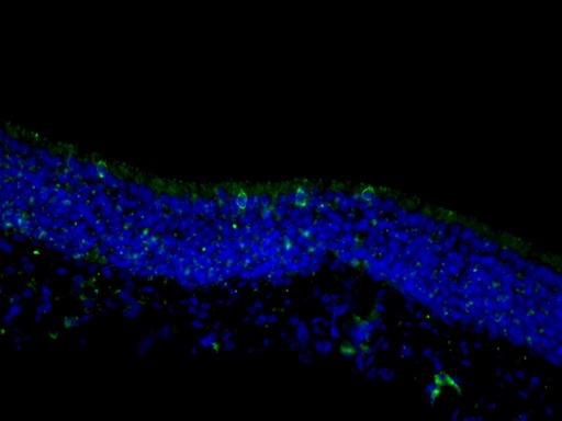 [18027-1-AP-150UL] TRPM5 Polyclonal antibody