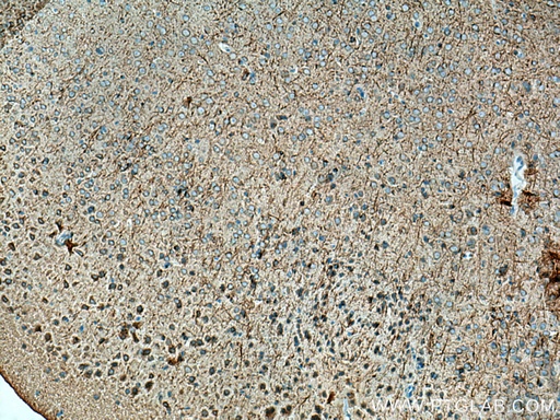 [18028-1-AP-150UL] STYK1 Polyclonal antibody