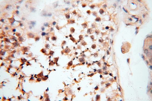 [18029-1-AP-150UL] CARD6 Polyclonal antibody
