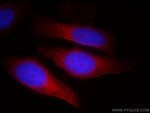 [18030-1-AP-20UL] TNKS Polyclonal antibody