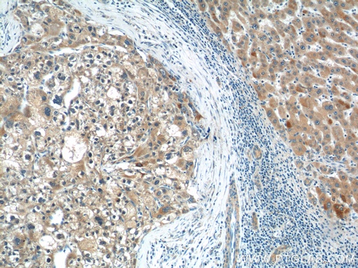 [18031-1-AP-20UL] CGNL1 Polyclonal antibody