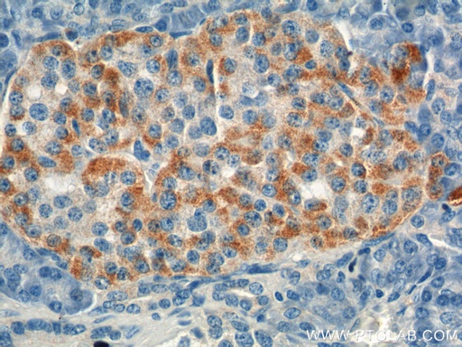 [18034-1-AP-20UL] GIP Polyclonal antibody