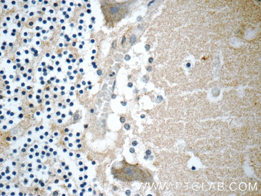 [18037-1-AP-150UL] CHRNB3 Polyclonal antibody
