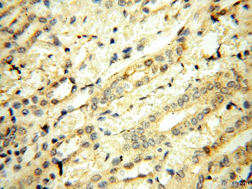 [18039-1-AP-150UL] UBA52 Polyclonal antibody