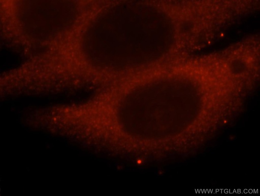 [18040-1-AP-150UL] Securin / PTTG1 Polyclonal antibody
