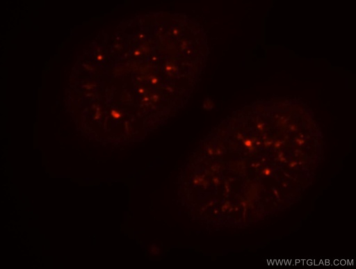 [18042-1-AP-150UL] CCNY Polyclonal antibody
