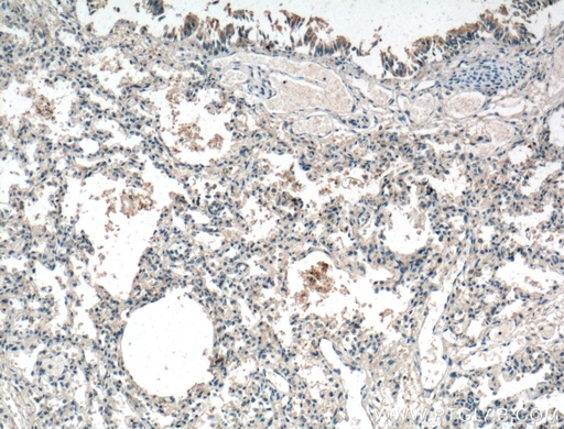 [18043-1-AP-150UL] IL-36 Beta/IL-1F8 Polyclonal antibody
