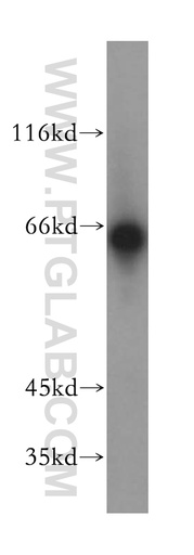[18044-1-AP-20UL] LGI2 Polyclonal antibody