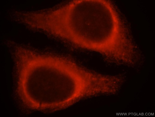[18045-1-AP-20UL] SERPINB13 Polyclonal antibody