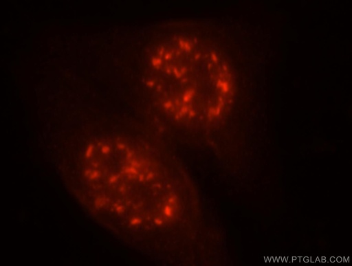 [18047-1-AP-20UL] MLN51/CASC3 Polyclonal antibody