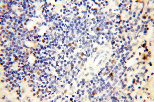 [18051-1-AP-150UL] DNA Ligase I Polyclonal antibody