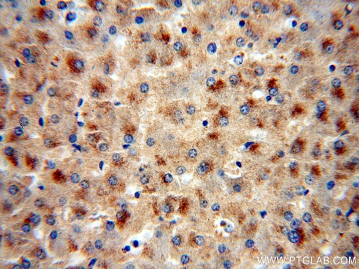 [18052-1-AP-150UL] fetuin-B Polyclonal antibody