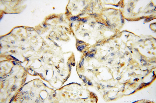 [18053-1-AP-150UL] PTPN14 Polyclonal antibody