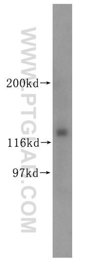 [18055-1-AP-150UL] KIRREL3 Polyclonal antibody