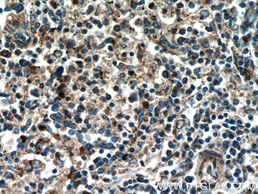 [18056-1-AP-150UL] TREML4 Polyclonal antibody