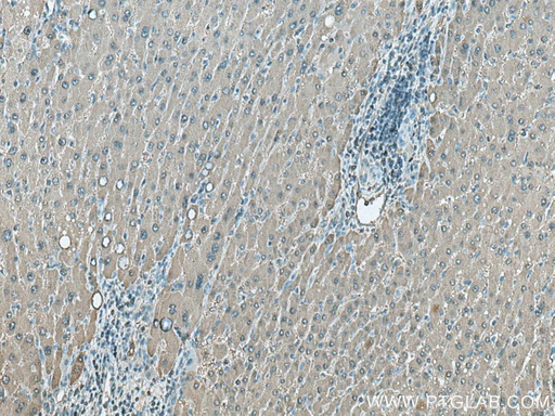 [18065-1-AP-20UL] ALDOB Polyclonal antibody