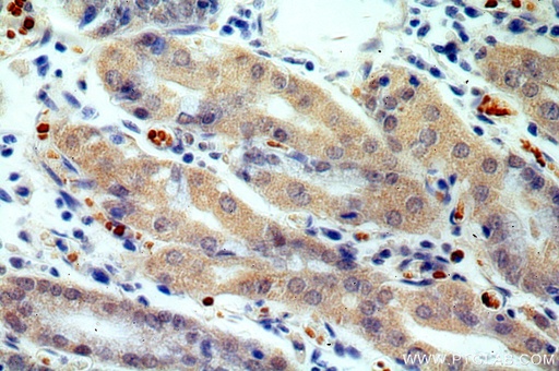 [18066-1-AP-150UL] USP49 Polyclonal antibody