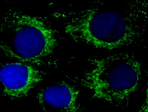 [18068-1-AP-150UL] PDH E1 Alpha Polyclonal antibody