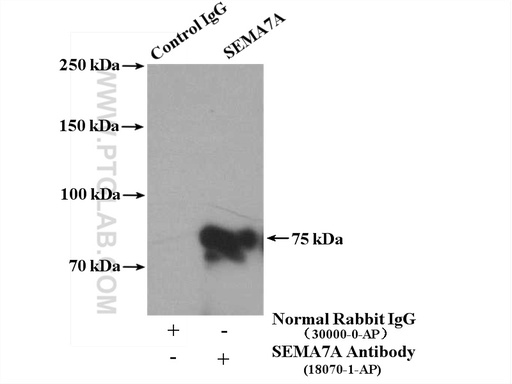 [18070-1-AP-150UL] SEMA7A Polyclonal antibody