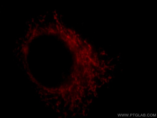 [18071-1-AP-150UL] COX18 Polyclonal antibody